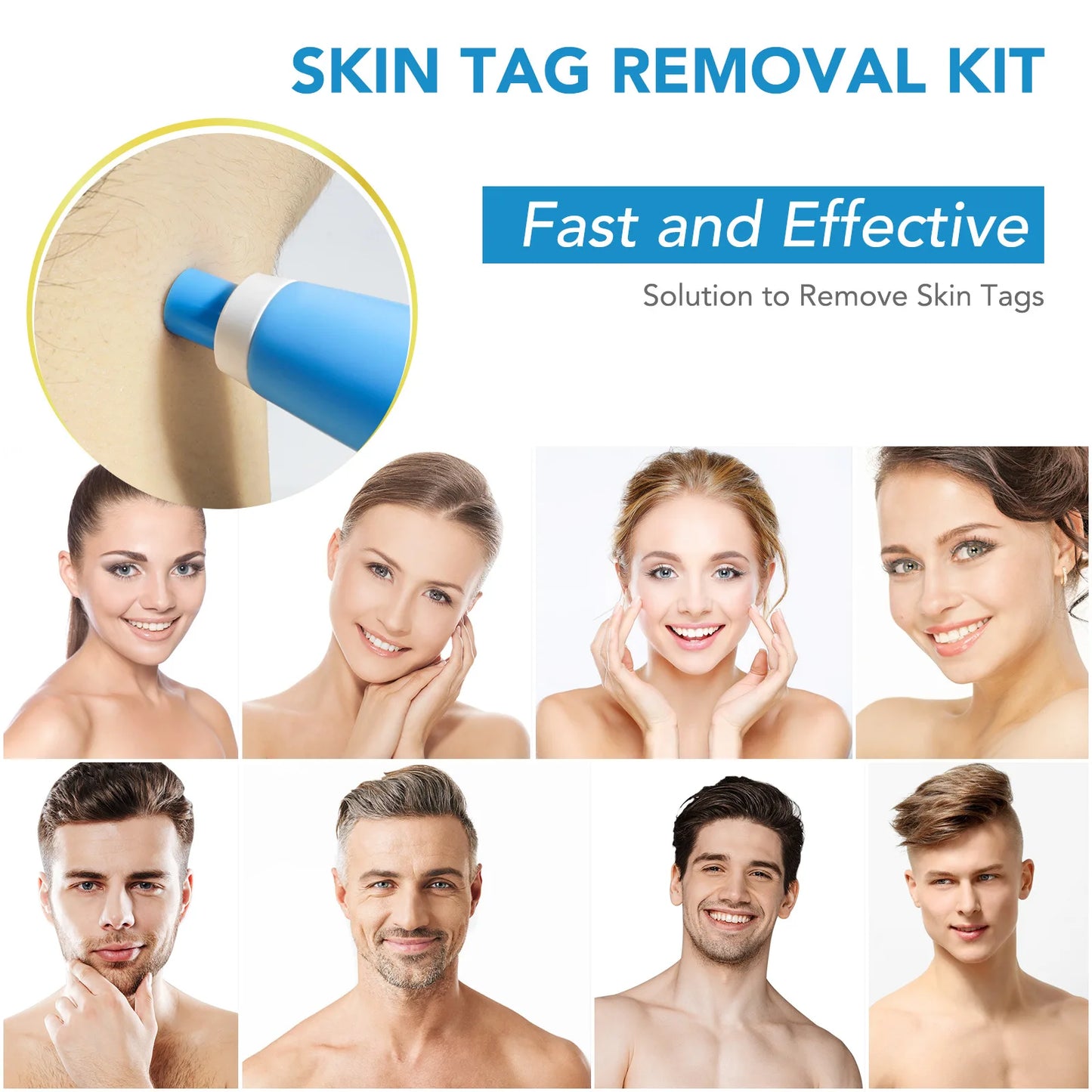 2 in 1 Auto Skin Tag Remover Kit Micro Skin Tag Removal Device Adult Mole Stain Wart Remover Face Care Beauty Tools Dropshipping